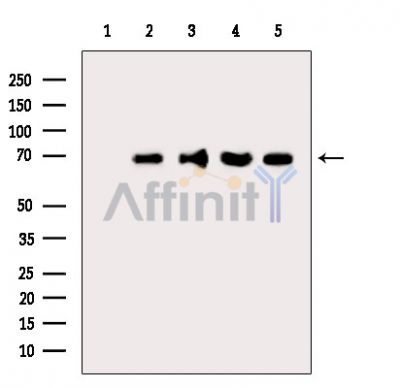 DLAT Antibody - Western blot analysis of extracts from various samples, using Pyruvate Dehydrogenase E2 Antibody.