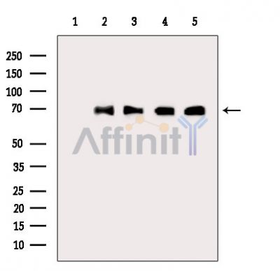DLAT Antibody - Western blot analysis of extracts from various samples, using Pyruvate Dehydrogenase E2 Antibody.