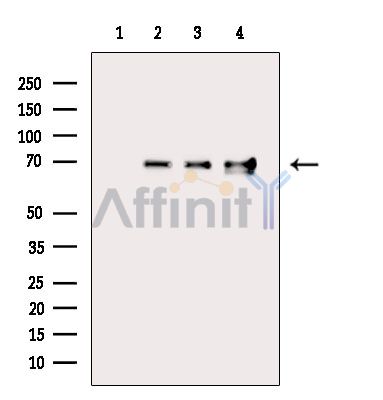 DLAT Antibody - Western blot analysis of extracts from various samples, using Pyruvate Dehydrogenase E2 Antibody.