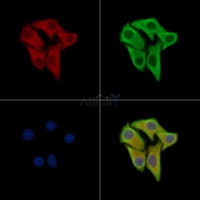 KBTBD10 Antibody - DF14047 staining Hela cells by IF/ICC.