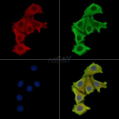 DHX29 Antibody - DF14056 staining Hela cells by IF/ICC.