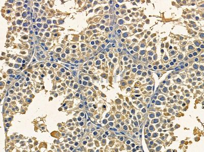 BPTF/FALZ Antibody - DF14063 at 1/100 staining mouse testis tissue by IHC-P.