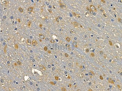 BPTF/FALZ Antibody - DF14063 at 1/100 staining rat brain tissue by IHC-P.