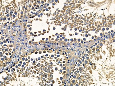 BPTF/FALZ Antibody - DF14063 at 1/100 staining rat testis tissue by IHC-P.