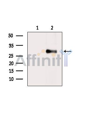 CLEC9A Antibody - Western blot analysis of extracts from HepG2 cells(heat-shock treatment), using CLEC9A Antibody.