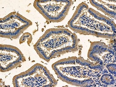 CLEC9A Antibody - DF14084 at 1/100 staining mouse colorectal tissue by IHC-P.