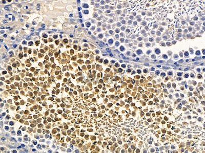 SLC26A8 Antibody - DF14159 at 1/100 staining rat testis tissue by IHC-P.