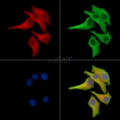 SLC26A8 Antibody - DF14159 staining Hela cells by IF/ICC.