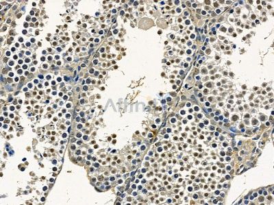 MOX1 Antibody - DF14205 at 1/100 staining mouse testis tissue by IHC-P.