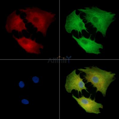 SPINK2 Antibody - DF14268 staining A549 cells by IF/ICC.
