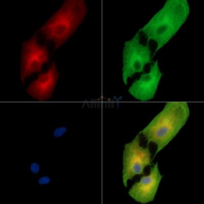 C1orf114 Antibody - DF14271 staining A549 cells by IF/ICC.