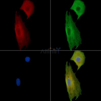 LRRC67 Antibody - DF14273 staining A549 cells by IF/ICC.