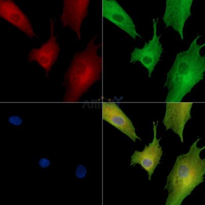FLG2 Antibody - DF14274 staining A549 cells by IF/ICC.