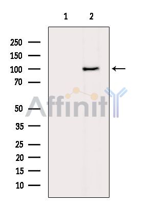 ZNRF3 Antibody - Western blot analysis of extracts from HepG2 cells(heat-shock treatment), using ZNRF3 Antibody.