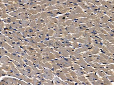 ZNRF3 Antibody - DF14289 at 1/100 staining rat heart tissue by IHC-P.