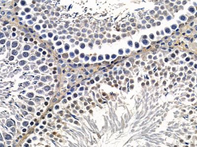 BRD9 Antibody - DF14352 at 1/100 staining rat testis tissue by IHC-P.