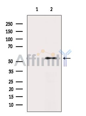RSL1D1 Antibody - Western blot analysis of extracts from Rat liver, using RSL1D1 Antibody.