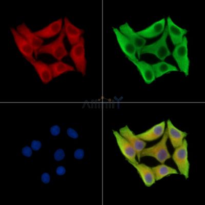 A2ML1 Antibody - DF14404 staining Hela cells by IF/ICC.