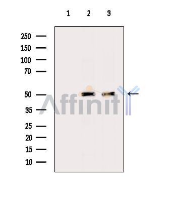 Alanine Transaminase Antibody - Western blot analysis of extracts from various samples, using Alanine Transaminase Antibody.