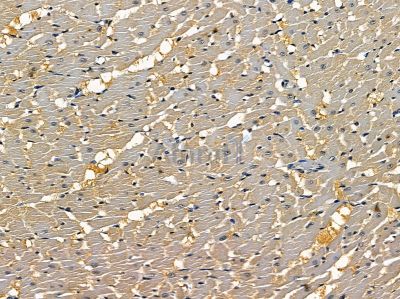 Alanine Transaminase Antibody - DF14428 at 1/100 staining rat heart tissue by IHC-P.
