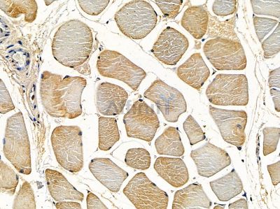 Alanine Transaminase Antibody - DF14428 at 1/100 staining rat muscle tissue by IHC-P.