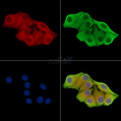 Alanine Transaminase Antibody - DF14428 staining Hela cells by IF/ICC.
