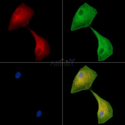 FXL19 Antibody - DF14439 staining A549 cells by IF/ICC.