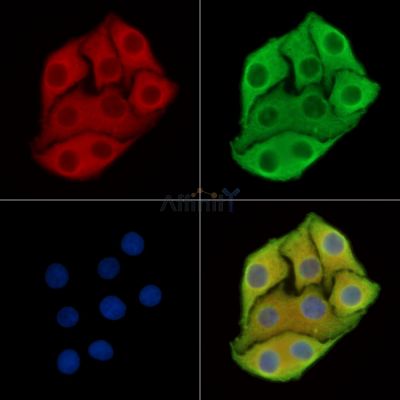 CP2BA Antibody - DF14449 staining Hela cells by IF/ICC.