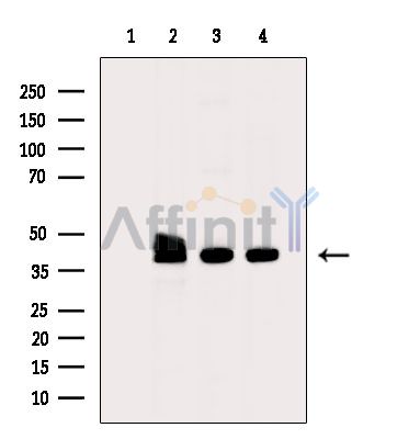 PPME1 Antibody - Western blot analysis of extracts from various samples, using PPME1 Antibody.