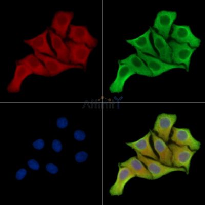 PPME1 Antibody - DF14474 staining Hela cells by IF/ICC.