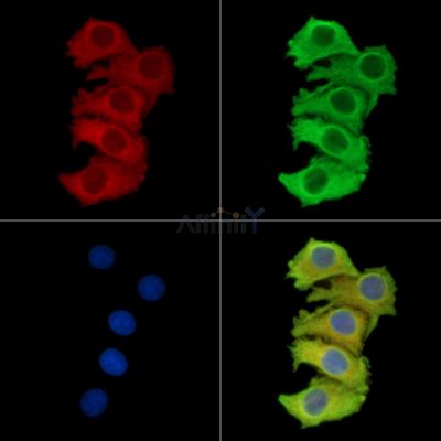 PAIP2 Antibody - DF14532 staining Hela cells by IF/ICC.