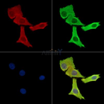 RASGRP4 Antibody - DF14835 staining Hela cells by IF/ICC.