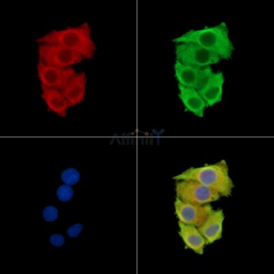AP4M1 Antibody - DF14837 staining Hela cells by IF/ICC.