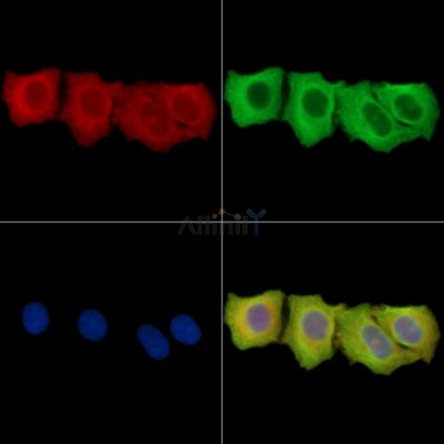 ENTPD6 Antibody - DF14840 staining Hela cells by IF/ICC.