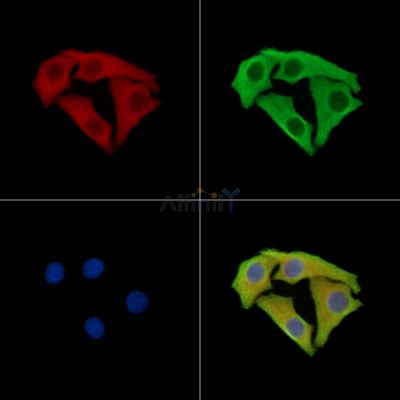 SCYL3 Antibody - DF14841 staining Hela cells by IF/ICC.