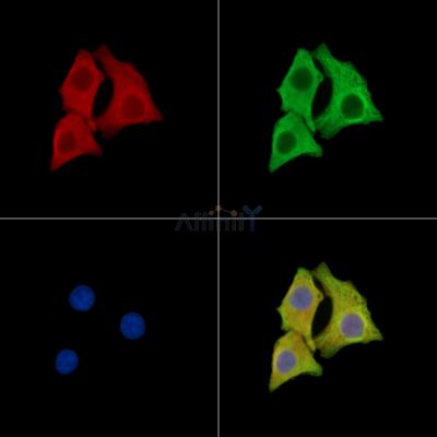 TMIE Antibody - DF14920 staining Hela cells by IF/ICC.