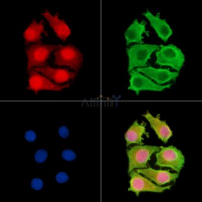 ZRANB1 Antibody - DF14929 staining Hela cells by IF/ICC.