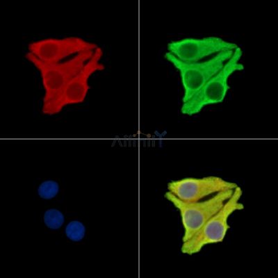 PAAF1 Antibody - DF14934 staining Hela cells by IF/ICC.