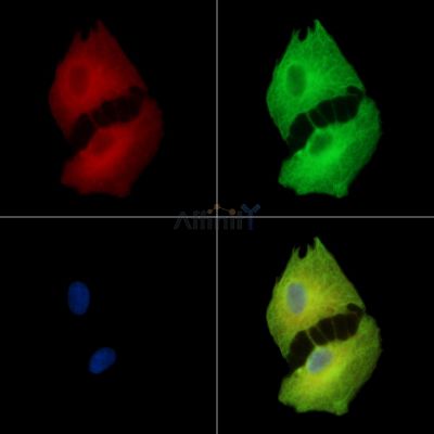 ANAPC10 Antibody - DF14981 staining A549 cells by IF/ICC.