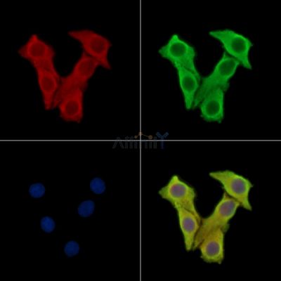 EDDM3B Antibody - DF15081 staining Hela cells by IF/ICC.