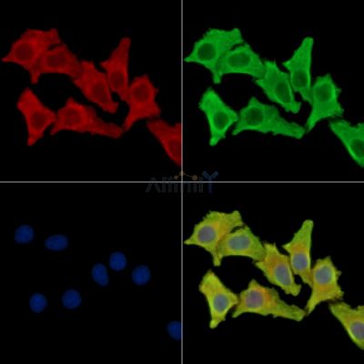 CCDC88C Antibody - DF15089 staining Hela cells by IF/ICC.
