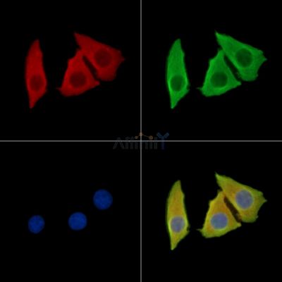 KANK4 Antibody - DF15100 staining Hela cells by IF/ICC.
