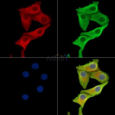 ADSS Antibody - DF15130 staining Hela cells by IF/ICC.