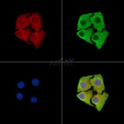 SBK2 Antibody - DF15150 staining Hela cells by IF/ICC.