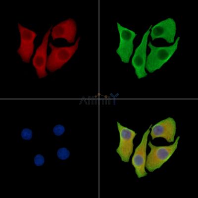 LZTS3 Antibody - DF15153 staining Hela cells by IF/ICC.