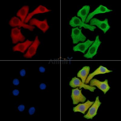 EPG5 Antibody - DF15156 staining Hela cells by IF/ICC.