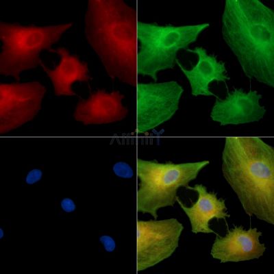 GPR42 Antibody - DF15240 staining A549 cells by IF/ICC.