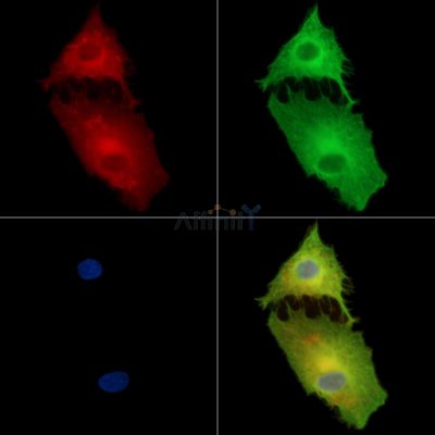 BBOX1 Antibody - DF15421 staining A549 cells by IF/ICC.