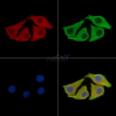TBC1D24 Antibody - DF15522 staining Hela cells by IF/ICC.