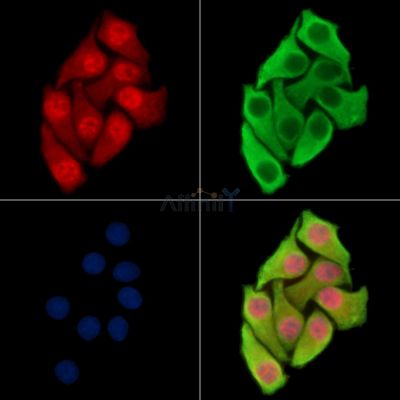 GMIP Antibody - DF15525 staining Hela cells by IF/ICC.